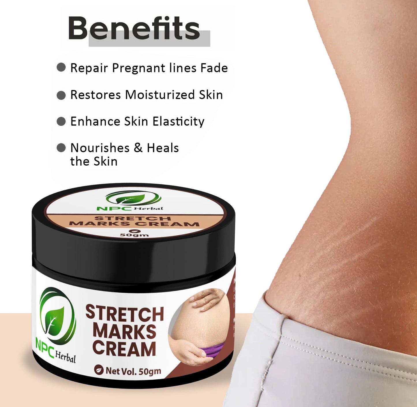 Stretch Marks Cream