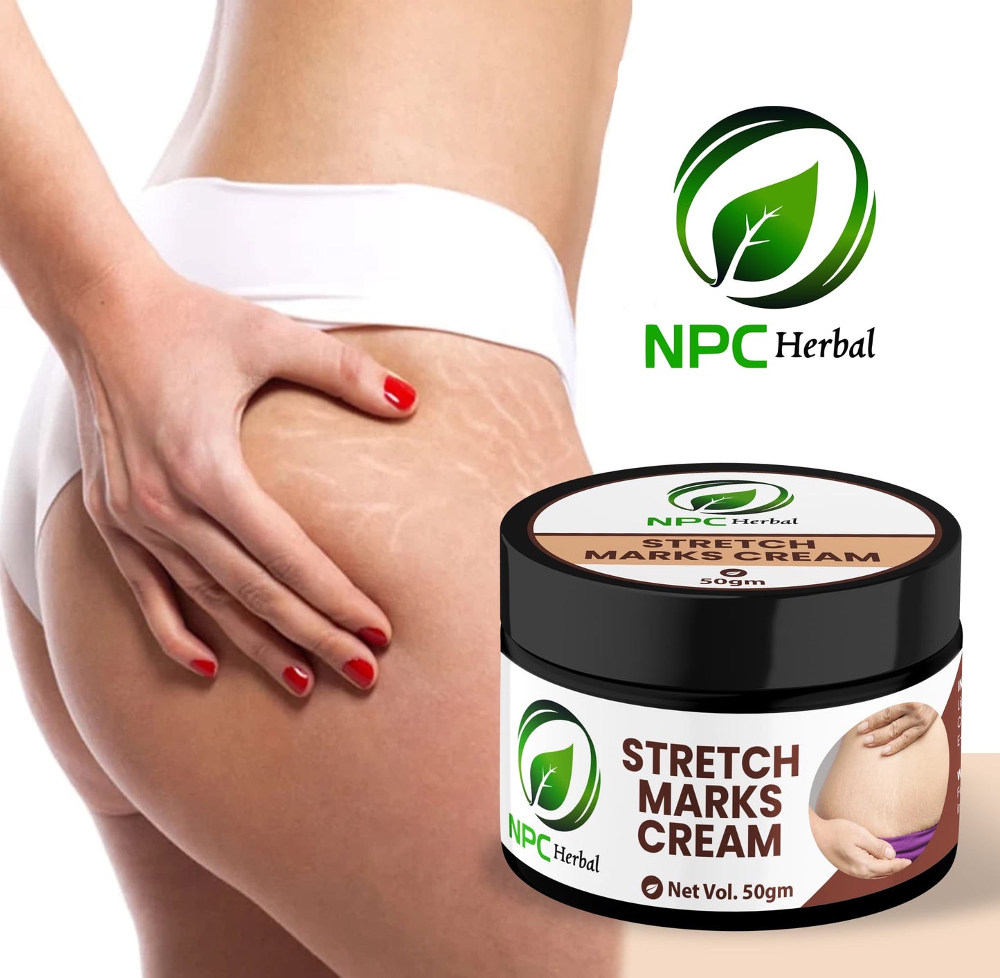 Stretch Marks Cream