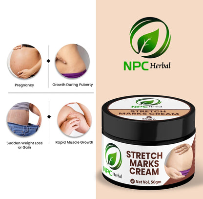 Stretch Marks Cream